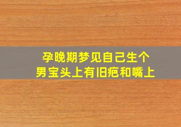 孕晚期梦见自己生个男宝头上有旧疤和嘴上