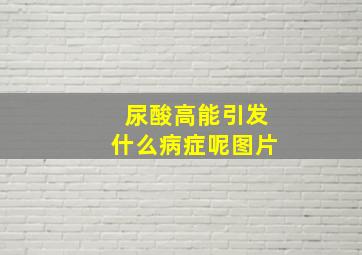 尿酸高能引发什么病症呢图片