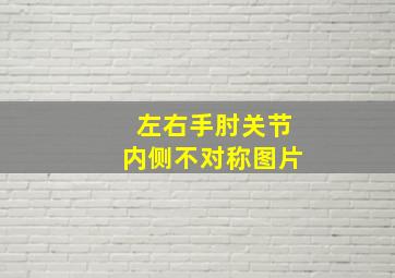 左右手肘关节内侧不对称图片