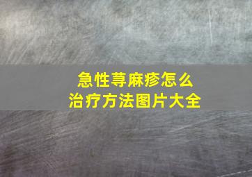 急性荨麻疹怎么治疗方法图片大全