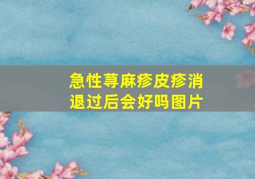 急性荨麻疹皮疹消退过后会好吗图片