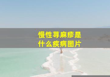 慢性荨麻疹是什么疾病图片