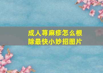 成人荨麻疹怎么根除最快小妙招图片