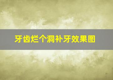 牙齿烂个洞补牙效果图