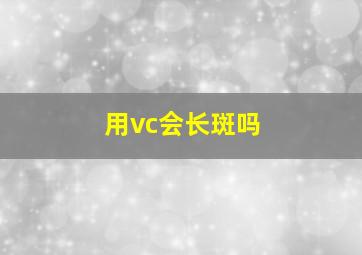 用vc会长斑吗