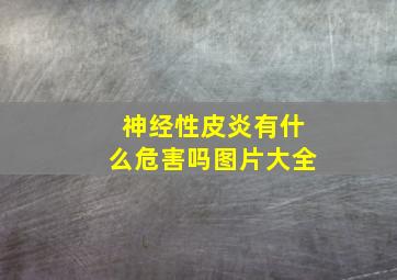 神经性皮炎有什么危害吗图片大全