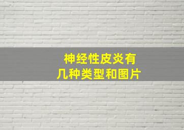 神经性皮炎有几种类型和图片