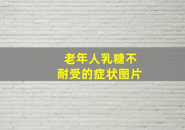 老年人乳糖不耐受的症状图片