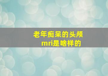 老年痴呆的头颅mri是啥样的