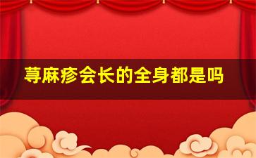 荨麻疹会长的全身都是吗