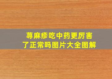 荨麻疹吃中药更厉害了正常吗图片大全图解