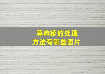 荨麻疹的处理方法有哪些图片