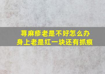 荨麻疹老是不好怎么办身上老是红一块还有抓痕